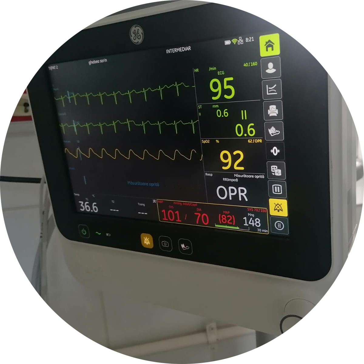 XBERSTAR Pezzo Di Contatto Del Vano Batteria Compatibile Con - Foto 8
